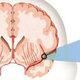 Illustration for article titled Obat Stroke Dari Tumbuhanem/em
